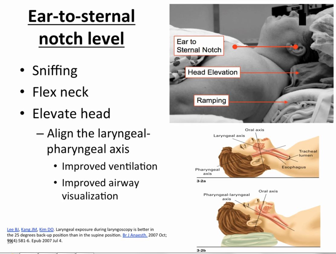 Slides and Resources from Dr. Brainard's Essential Emergency Airway Care  Course #2 – Oxygenation and BVM - Tom Wade MD