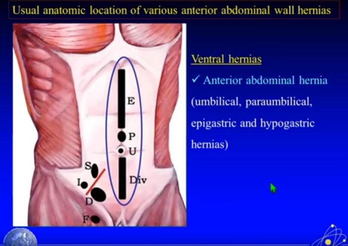 Spigelian Hernia Ultrasound Protocol Spigelian Hernia Ultrasound Protocol